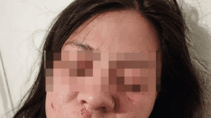 Detienen a policía que agredió a su ex pareja en Galaxia La Calera, Puebla