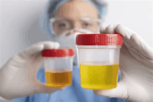 Aumentan infecciones urinarias en México